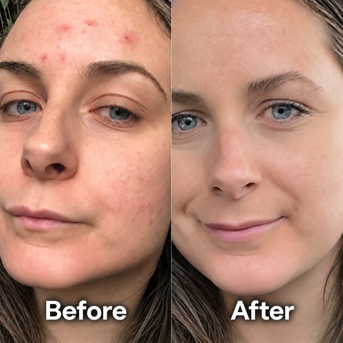 Solard Exfoliating Serum