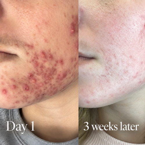 Solard Exfoliating Serum