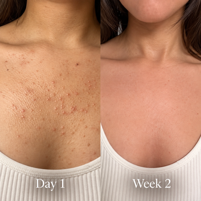 Solard Exfoliating Serum