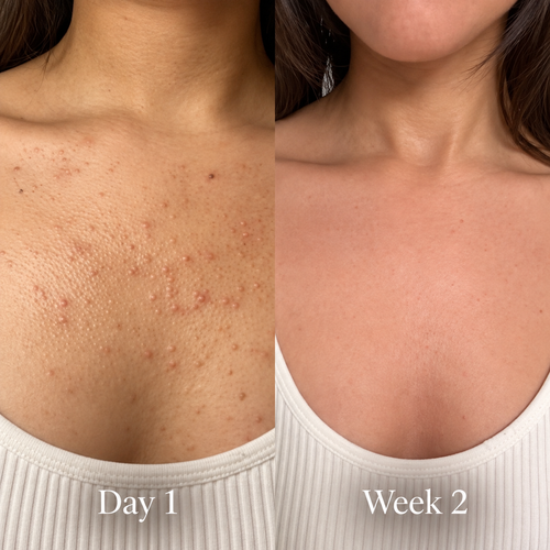 Solard Exfoliating Serum