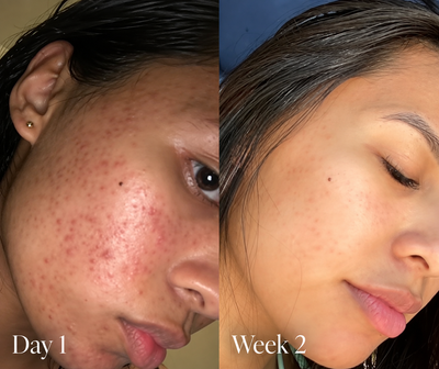 Solard Exfoliating Serum